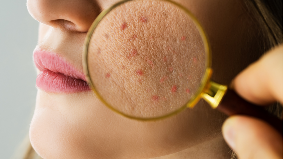 Hidratação Inteligente: Escolhendo os Melhores Aliados para a Pele - inspiração 1