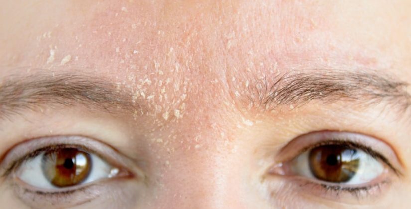 O Poder dos Antioxidantes para Proteger e Regenerar - inspiração 2