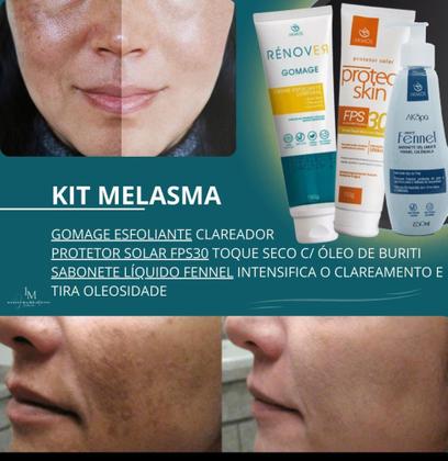 Quando Procurar um Dermatologista para Clareamento Facial - inspiração 2