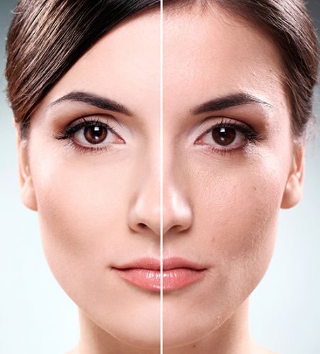 Ingredientes-Chave para um Clareamento Seguro e Eficaz - inspiração 2