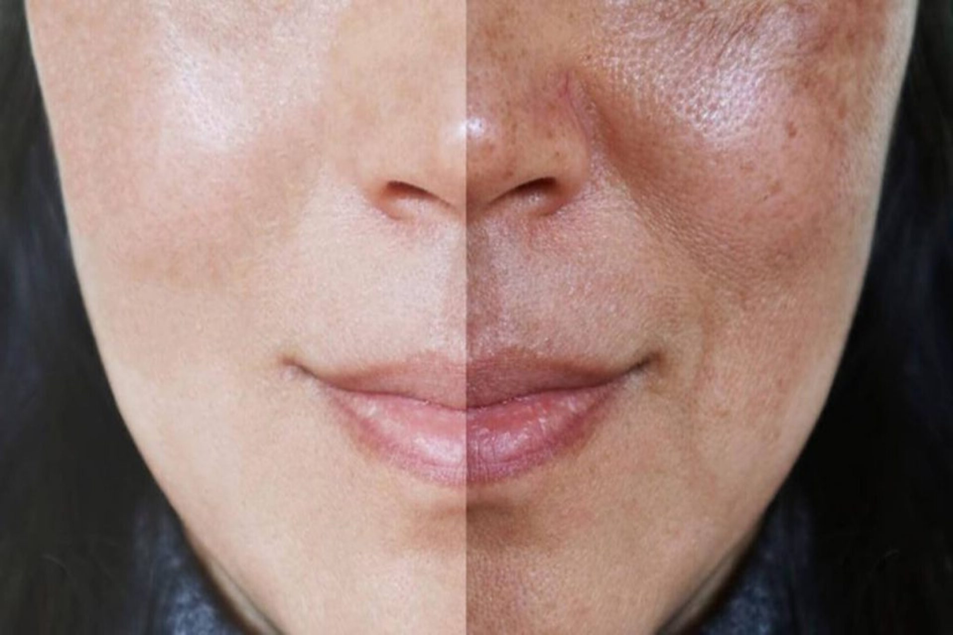 Rotina de Skincare Ideal para Peles com Manchas - inspiração 2