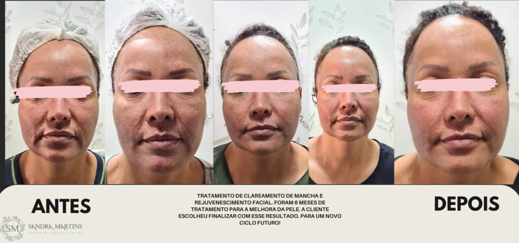 Tratamentos Profissionais: O Que Você Precisa Saber - inspiração 2