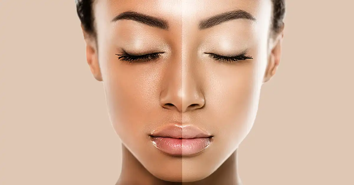 Mitos e Verdades Sobre Clareamento Facial Caseiro - inspiração 2