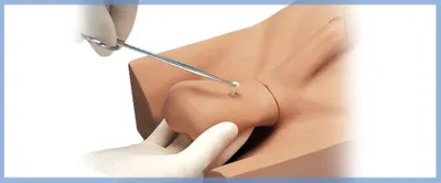 Quem Deve Considerar a Vasectomia? - inspiração 2