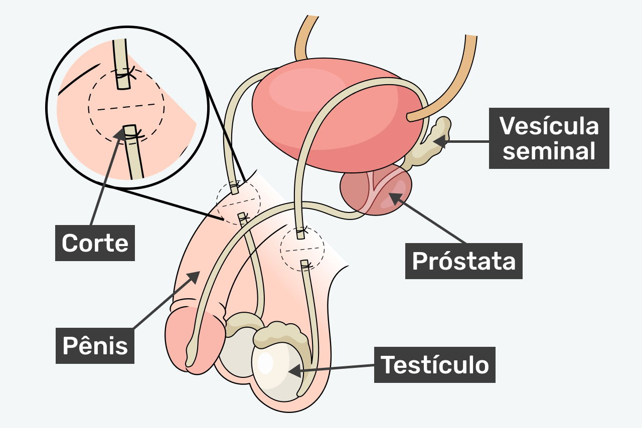 Preparação Essencial Antes da Cirurgia - inspiração 1