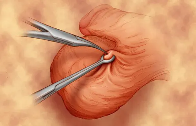 Preparação Essencial Antes da Cirurgia - inspiração 2