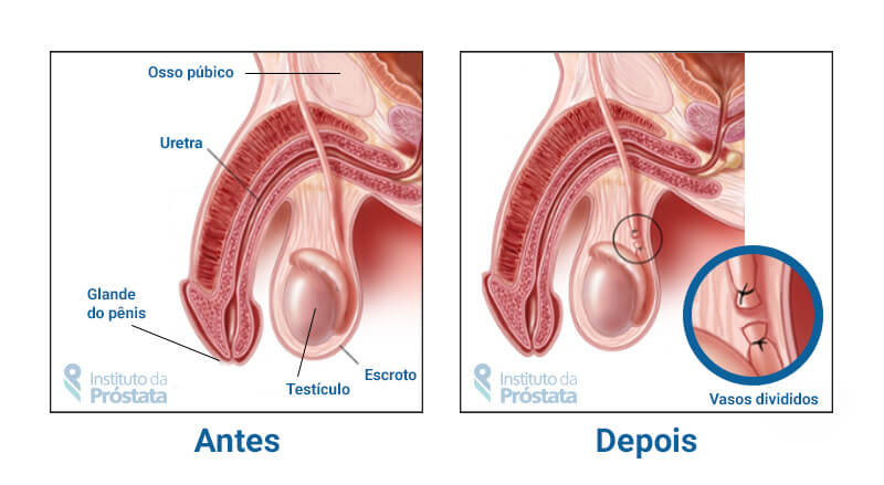 O Procedimento Cirúrgico: Passos e Duração - inspiração 1