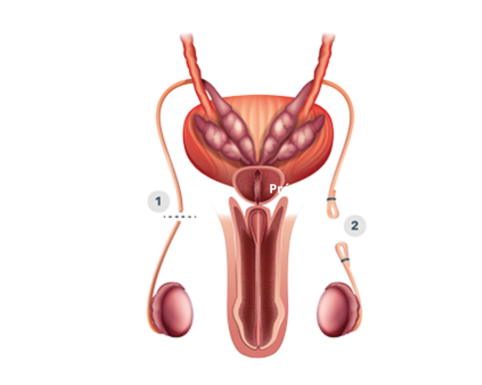 O Procedimento Cirúrgico: Passos e Duração - inspiração 2