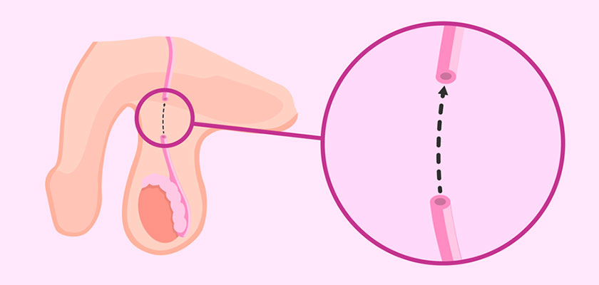 Eficácia e Confiança do Método Contraceptivo - inspiração 2