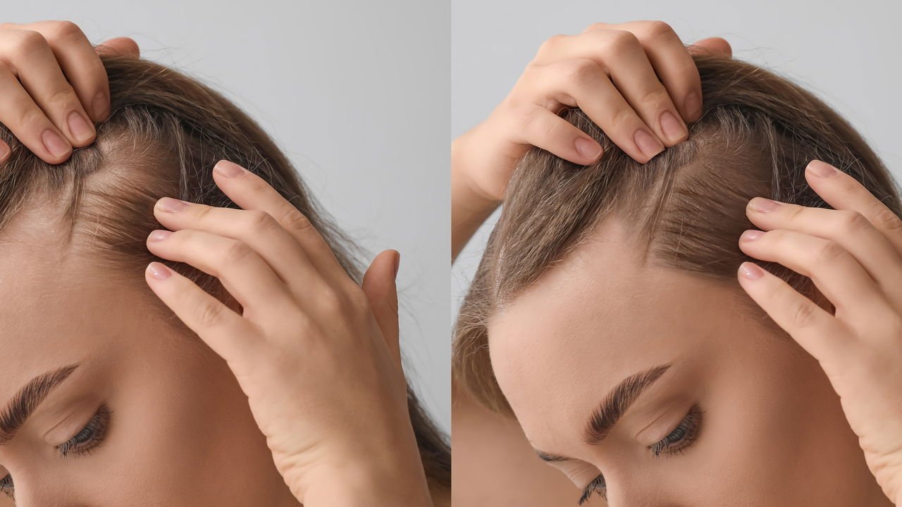 Massagem no Couro Cabeludo: Estimulando a Circulação Sanguínea - inspiração 2