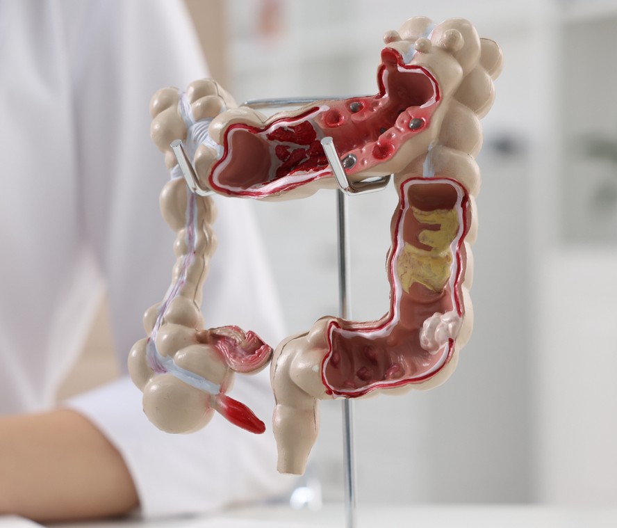 Massagem Abdominal: Um Carinho que Estimula o Movimento - inspiração 1