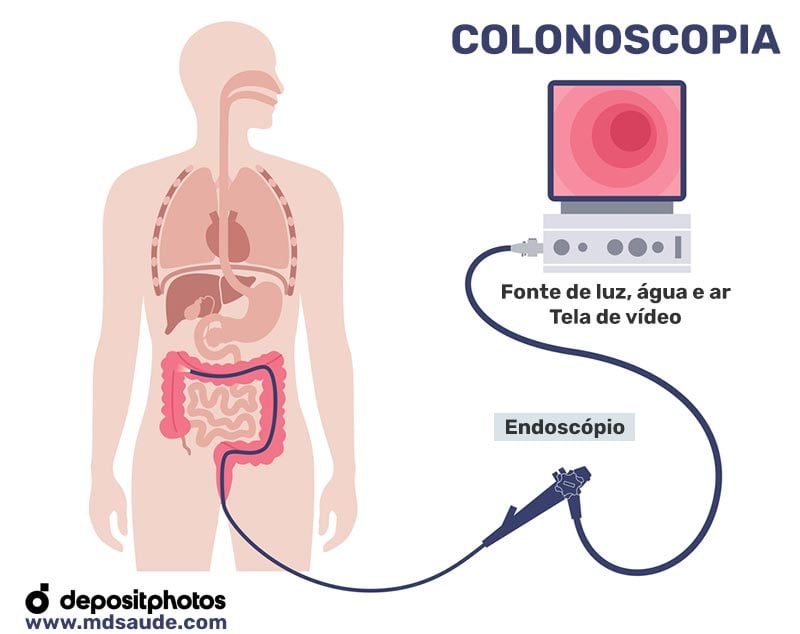Após o Exame: Cuidados e Recuperação Rápida - inspiração 1
