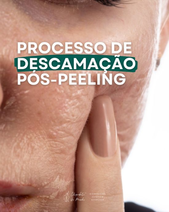 Proteção Solar: O Escudo Essencial Contra Manchas - inspiração 1