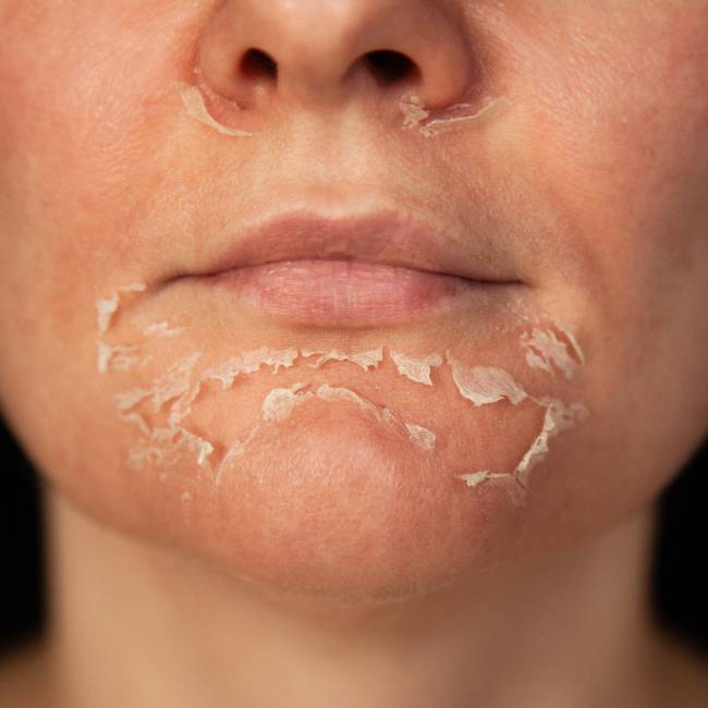 Tempo de Cicatrização: Entendendo a Regeneração - inspiração 2