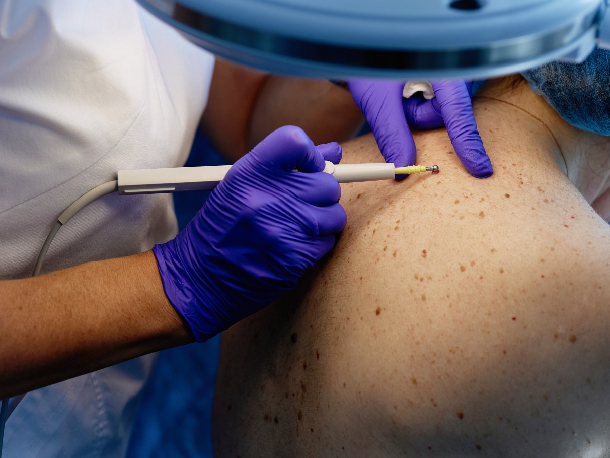 Por Que Fazer um Diagnóstico de Pele é Essencial? - inspiração 2