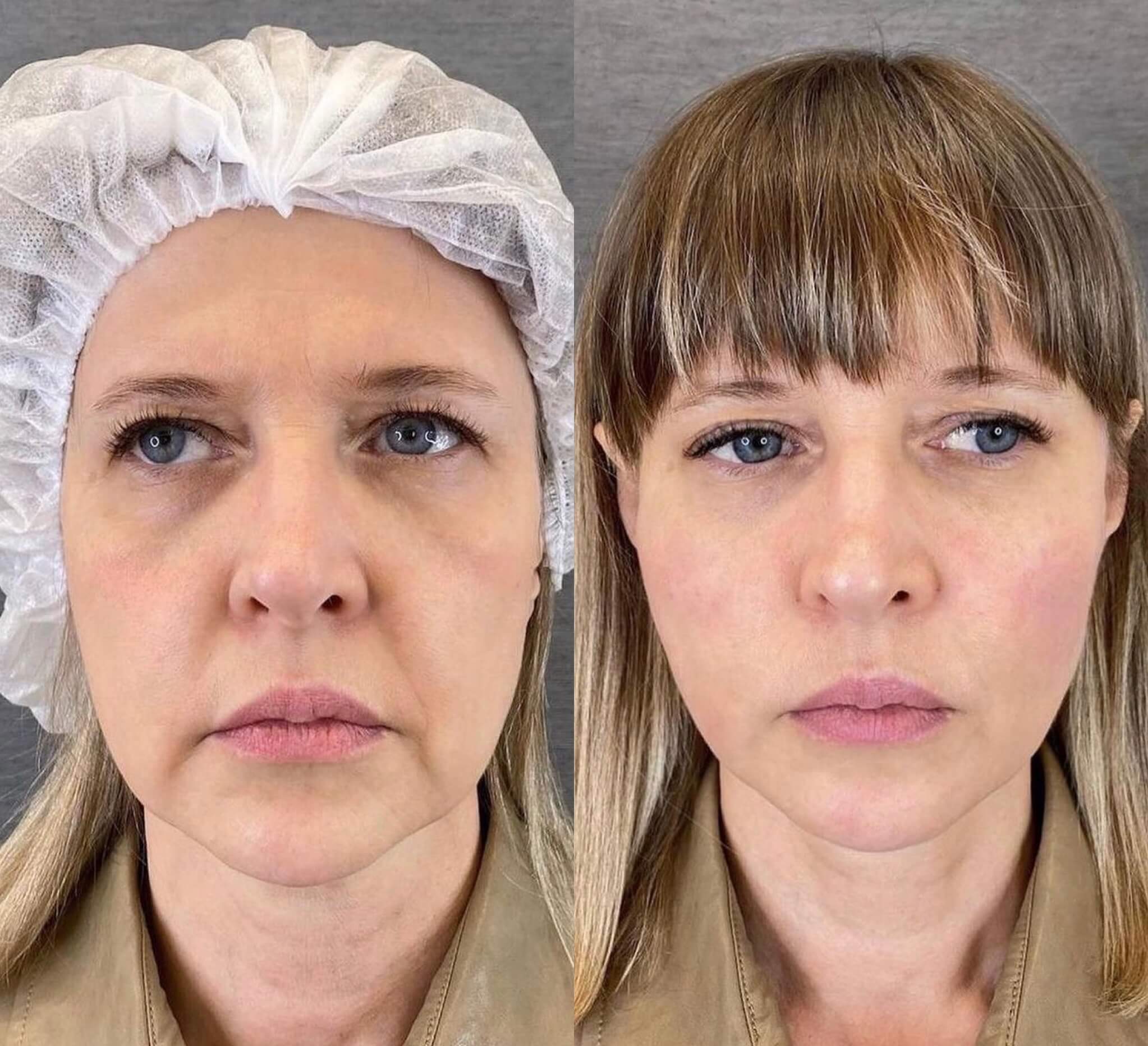 Proteínas magras: A base para a construção do colágeno - inspiração 1