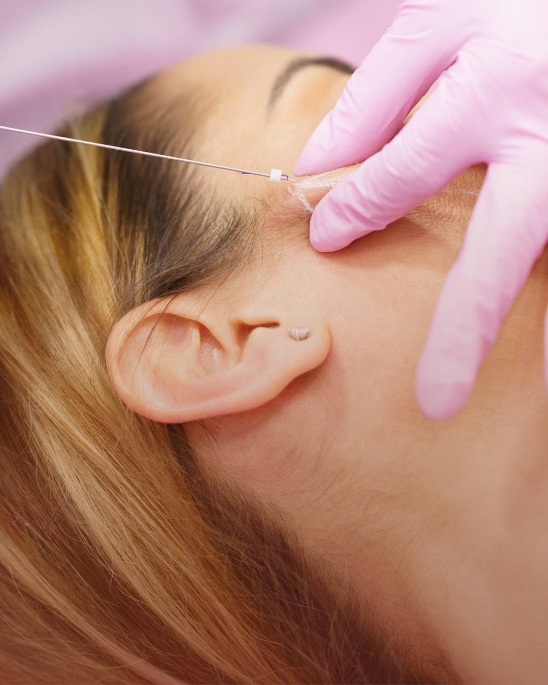 Redução do estresse: Um fator frequentemente negligenciado - inspiração 2