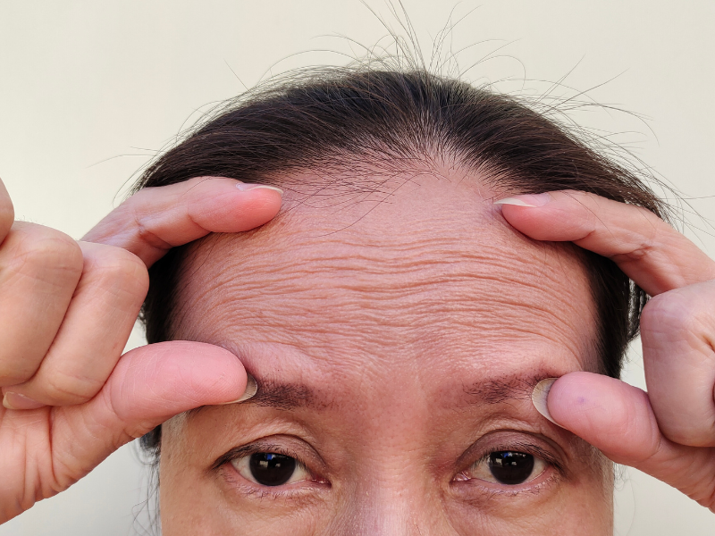 O Papel Crucial da Hidratação na Elasticidade - inspiração 2