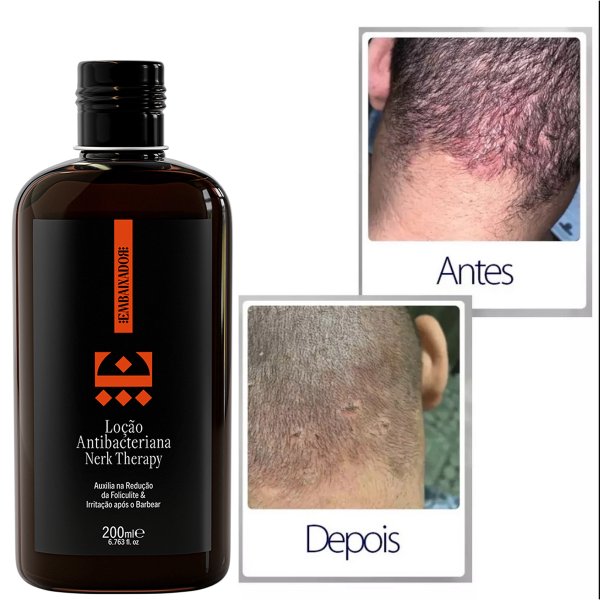 Mitos e verdades: o que você precisa saber sobre o uso. - inspiração 2