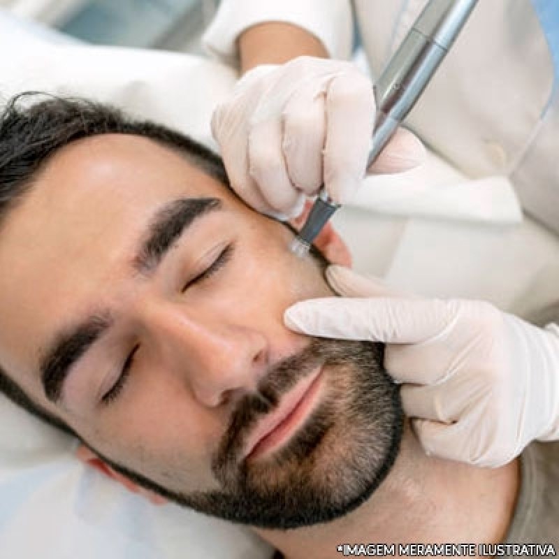 O Que Esperar Durante o Procedimento - inspiração 2