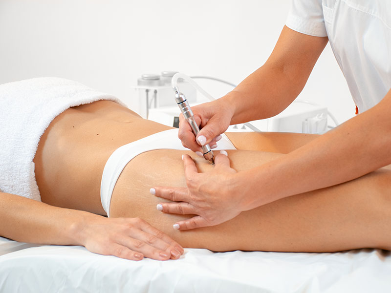 Microdermoabrasão vs. Outros Peelings: Qual a Diferença? - inspiração 2