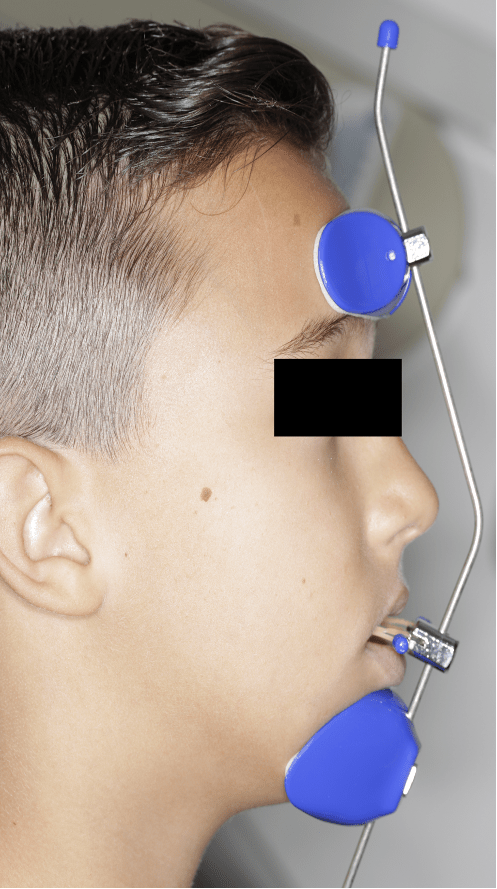 Técnicas de Aplicação para Maximizar os Resultados - inspiração 1