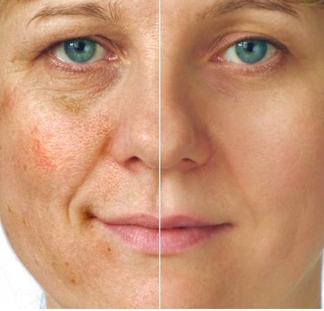 Tipos de ácidos mais usados e suas funções específicas - inspiração 1