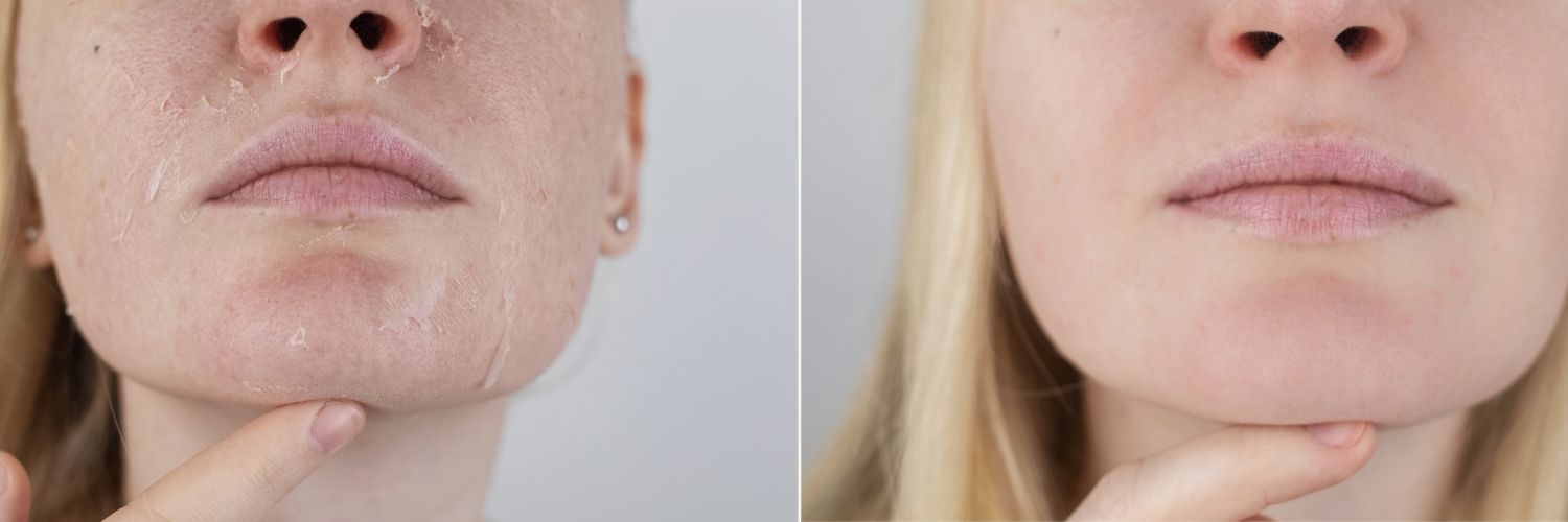 Tipos de ácidos mais usados e suas funções específicas - inspiração 2