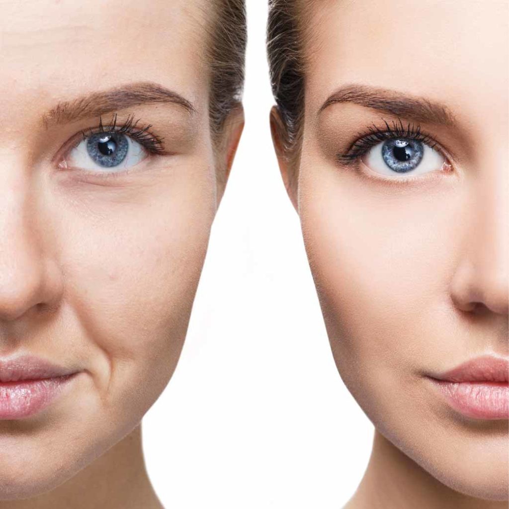 Como preparar a pele antes de realizar o procedimento - inspiração 2