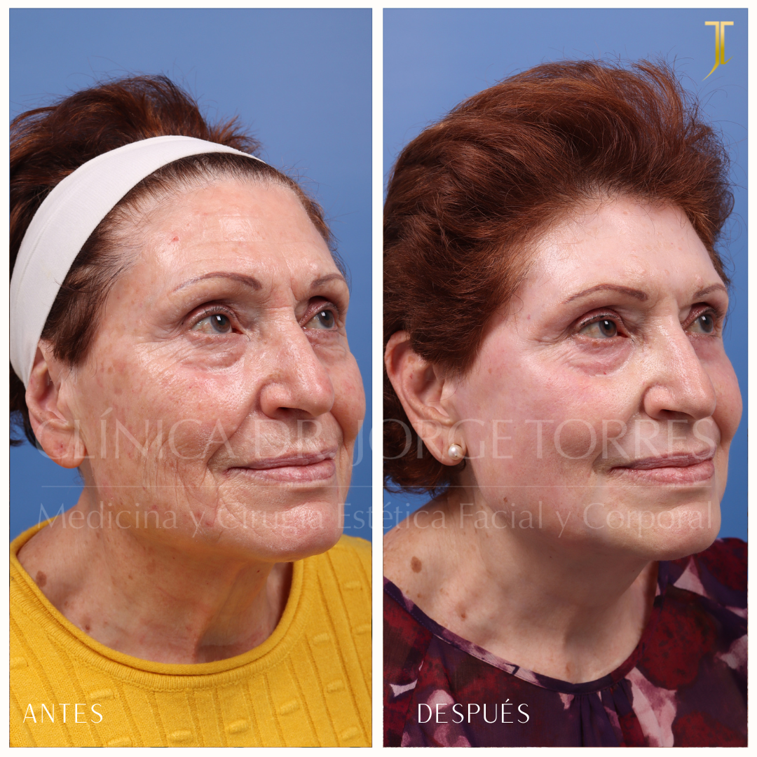 Benefícios Claros que Você Vai Amar - inspiração 1