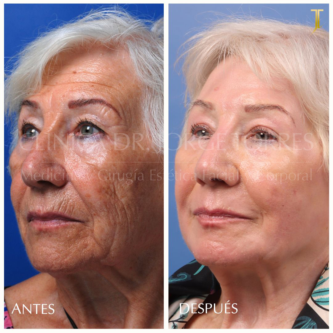 Benefícios Claros que Você Vai Amar - inspiração 2