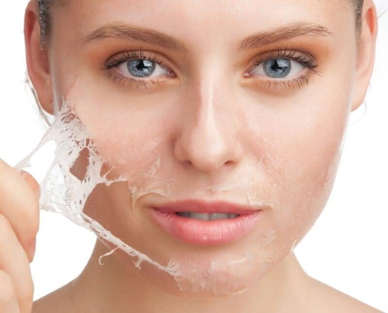 Os Tipos de Peeling Profundo e Suas Diferenças - inspiração 2