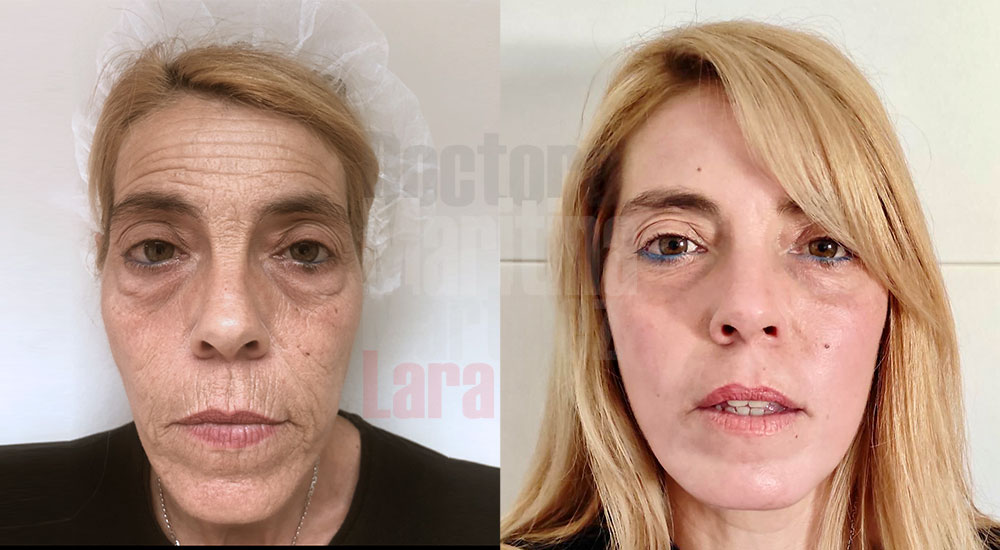 Como se Preparar para o Procedimento - inspiração 1