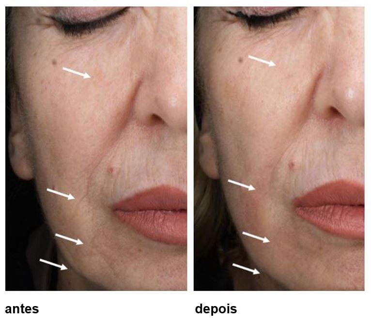 Como se Preparar para o Procedimento - inspiração 2