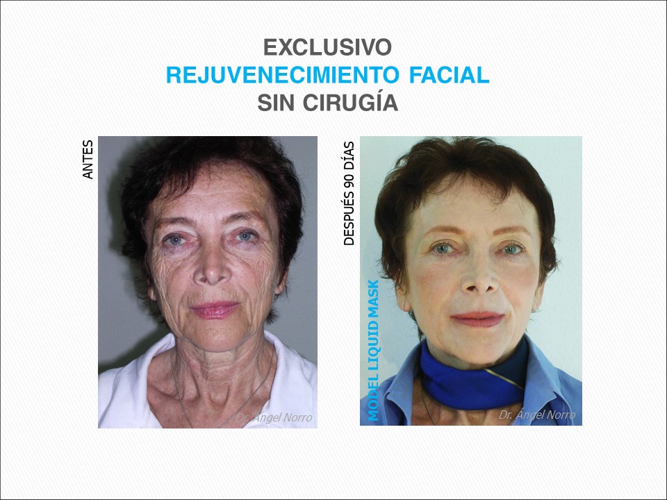 O Que Esperar Durante a Sessão - inspiração 2