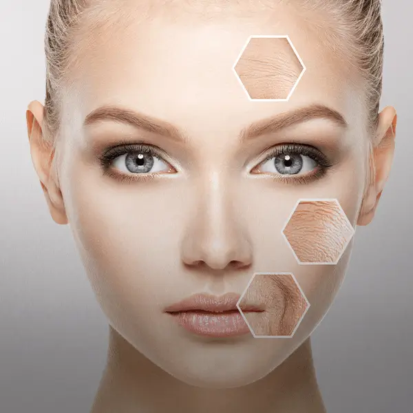 Cuidados Essenciais Pós-Peeling Profundo - inspiração 1