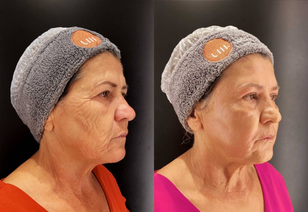 Riscos e Efeitos Colaterais a Considerar - inspiração 2