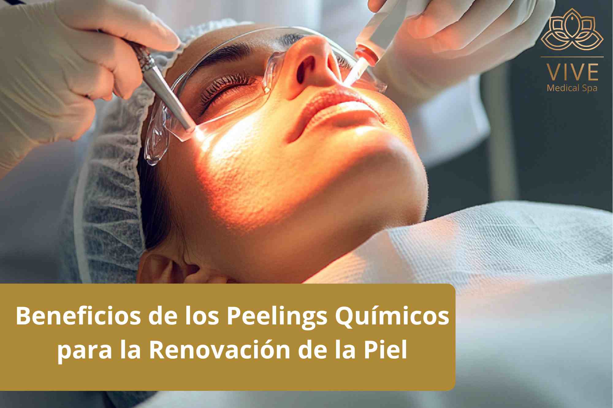 Mitos e Verdades Sobre os Peelings Químicos - inspiração 1