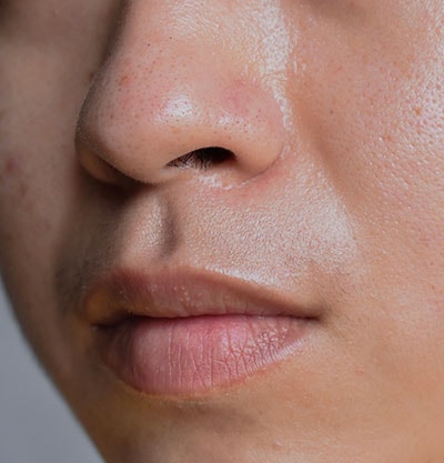 Identificando as Áreas Oleosas e Secas da Sua Pele - inspiração 2