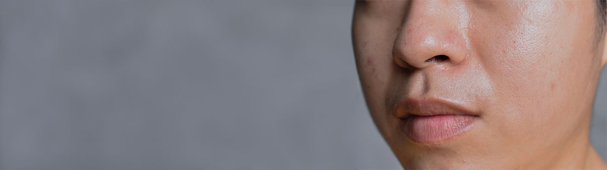 Erros Comuns a Evitar no Cuidado da Pele Mista - inspiração 2