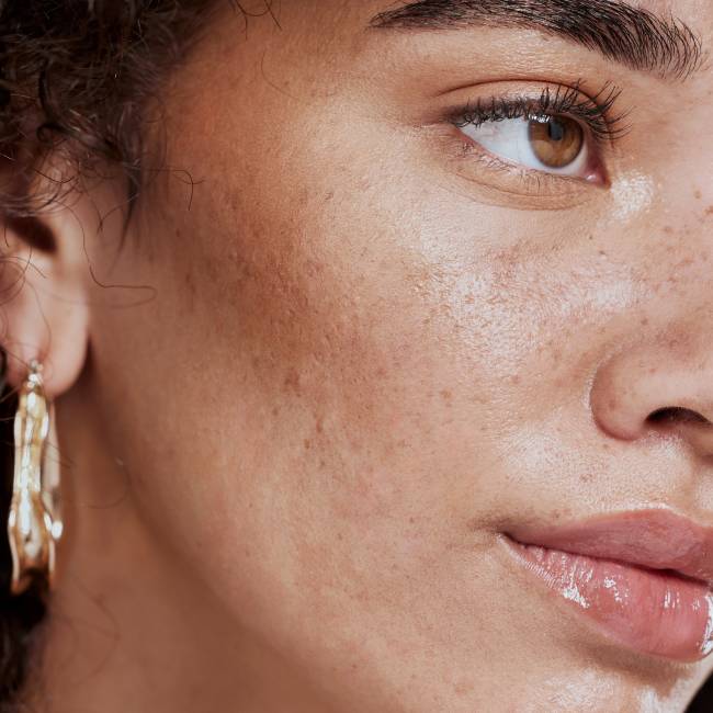 Hidratação Estratégica: Uma para Cada Necessidade - inspiração 1