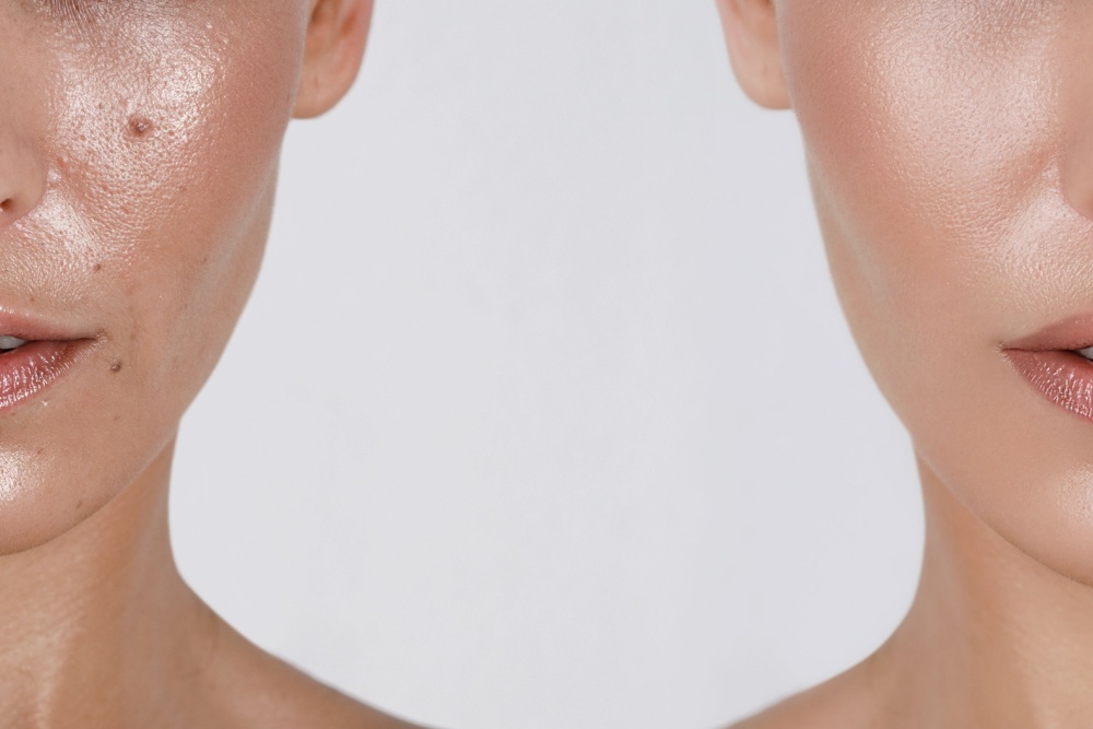 Alimentação e Estilo de Vida: Impacto Direto - inspiração 2