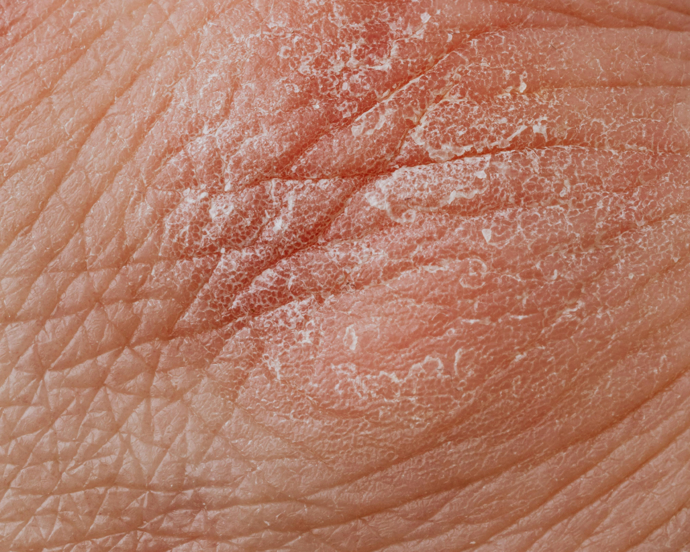 Rotina de Higiene: Menos é Mais para Sua Pele - inspiração 1