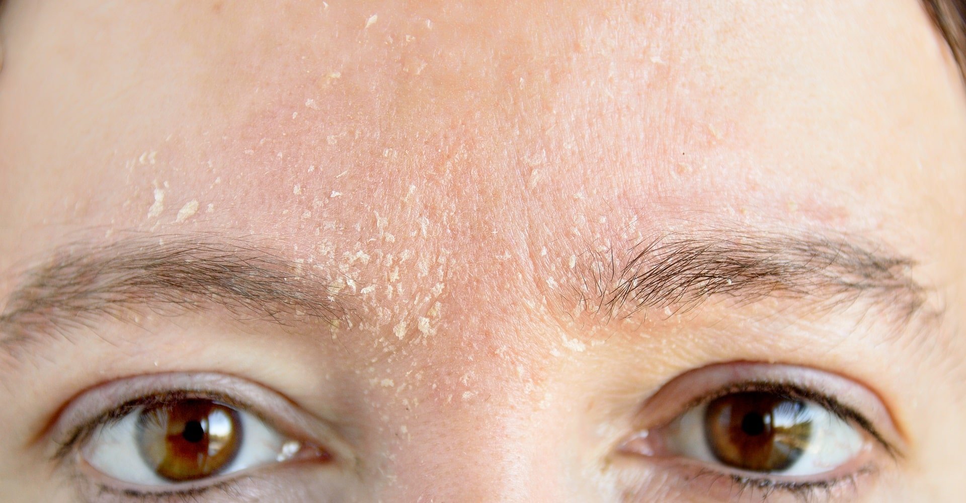 Hidratação Profunda: Ingredientes que Fazem a Diferença - inspiração 1