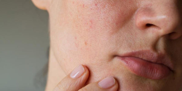 O Poder dos Óleos Naturais no Resgate da Pele - inspiração 1