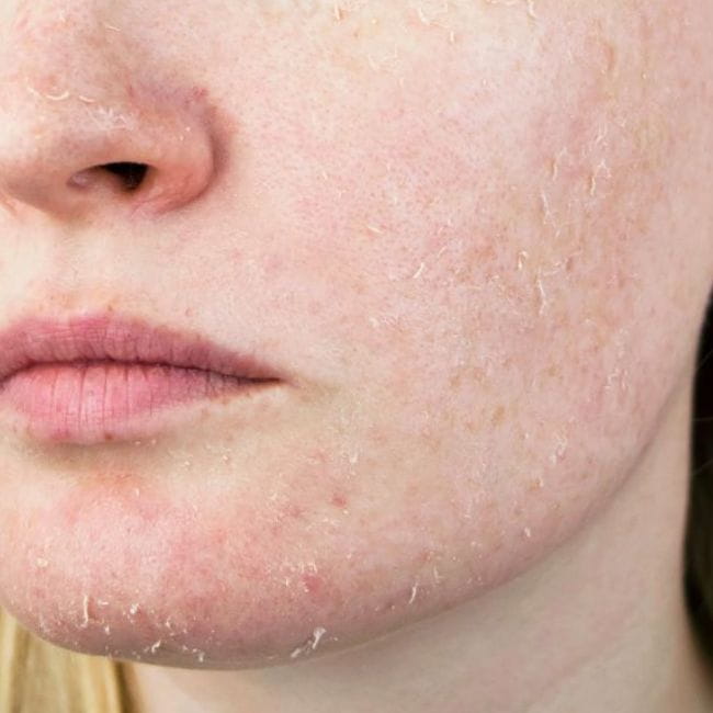 Proteção Contra Agentes Externos: Escudo Invisível - inspiração 1