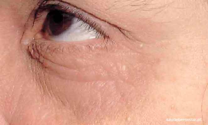 Quando Procurar Ajuda Profissional? - inspiração 1