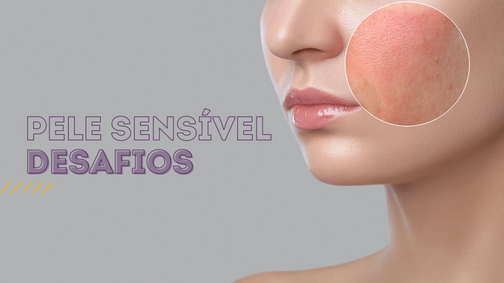 Vermelhidão e Irritação: O Alerta Vermelho da Sua Pele - inspiração 1