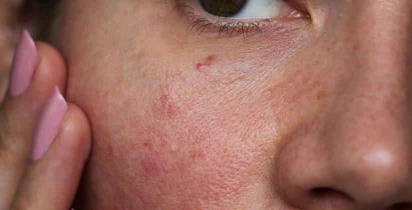 Coceira e Ardência: Reações Comuns que Pedem Atenção - inspiração 1