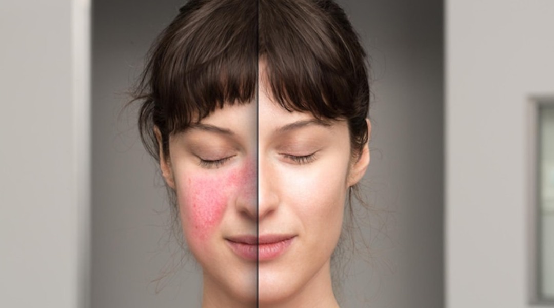 Rotina de Skincare: Simplificando Para Calmar Sua Pele - inspiração 1